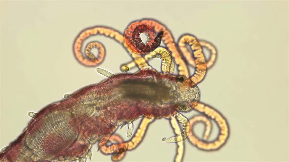 Worm Proceraea Sp. Under a Microscope, the Syllidae Family, the Polychaeta Class, Was Found in the alt