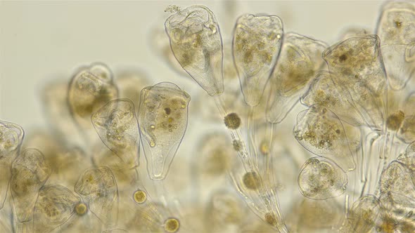 Infusoria Vorticella Under the Microscope, Class Oligohymenophorea ...