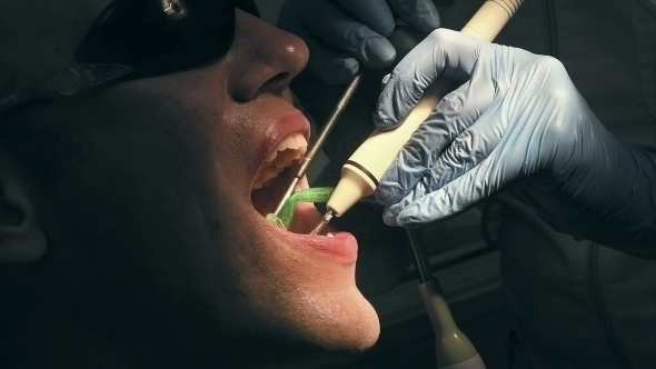 Mid Age Man Gets Medical Teeth Removing Calculus