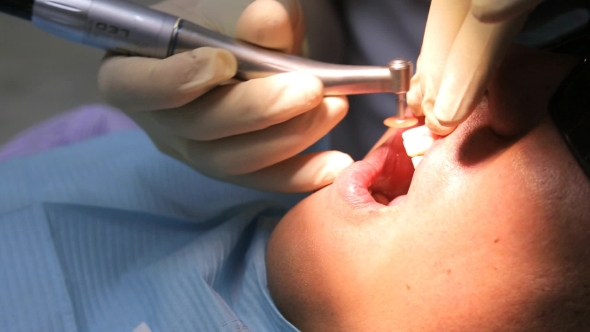 Finishing Bevel Of Enamel With Help Of Disc Handpiece