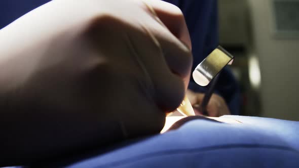 Close-up of surgeons performing operation in operation room alt