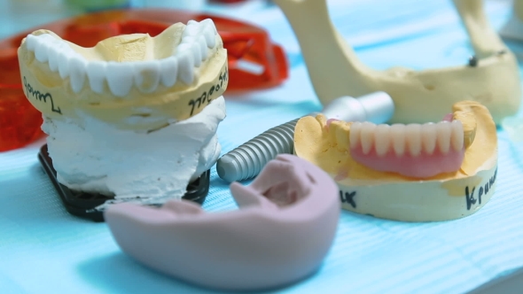 Casts Of The Teeth And Jaws alt