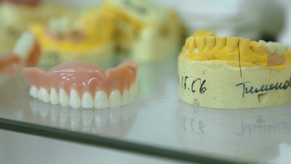 Prosthetic Dentistry. Casts Of The Jaws alt