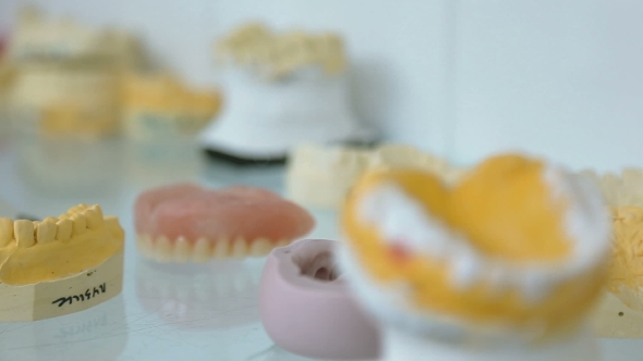 Models of Dentures alt