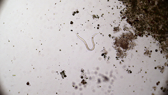 Microscopy: Vinegar Eels (Turbatrix Aceti ,Vinegar Nematode) 01