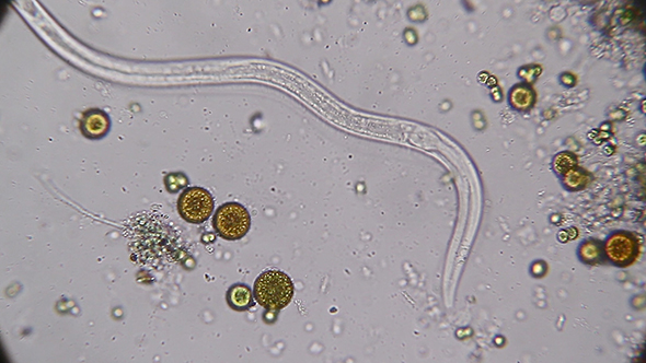 Microscopy: Vinegar Eels (Turbatrix Aceti ,Vinegar Nematode) 03