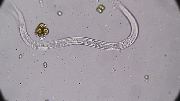 Microscopy: Vinegar Eels (Turbatrix Aceti ,Vinegar Nematode) 04