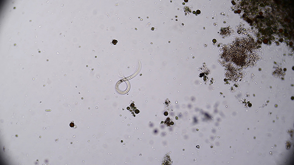 Microscopy: Vinegar Eels (Turbatrix Aceti ,Vinegar Nematode) 05