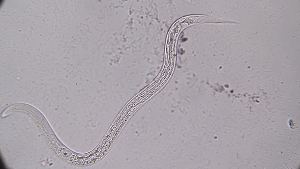 Microscopy: Vinegar Eels (Turbatrix Aceti ,Vinegar Nematode) 06