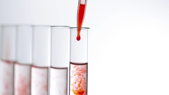 A Pipette Drips Blood Into a Test Tubes