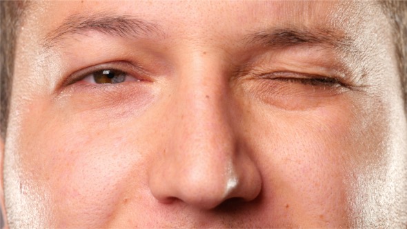 Man With Different Eyes Winks alt