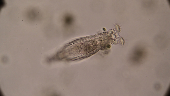 Microscopy: Rotifer Mniobia Magna 01