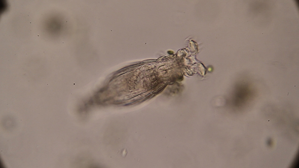Microscopy: Rotifer Mniobia Magna 02