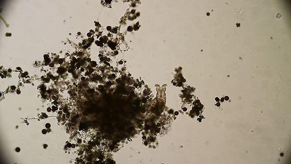 Microscopy: Rotifer Mniobia Magna 03