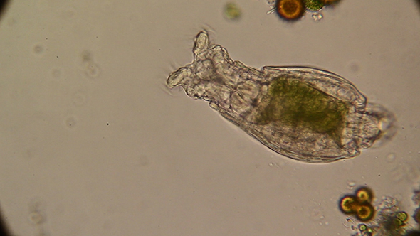 Microscopy: Rotifer Mniobia Magna 04