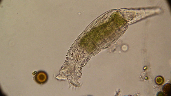 Microscopy: Rotifer Mniobia Magna 05