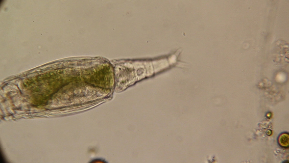Microscopy: Rotifer Mniobia Magna 06