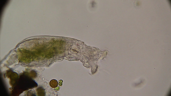 Microscopy: Rotifer Mniobia Magna 08