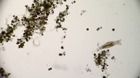 Microscopy: Rotifer Mniobia Magna 10