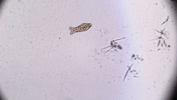 Microscopy: Rotifer Mniobia Magna 11