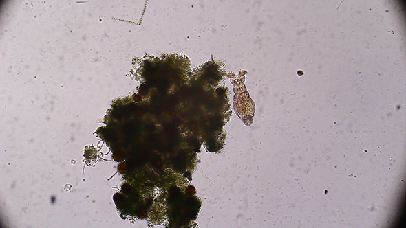 Microscopy: Rotifer Mniobia Magna 13