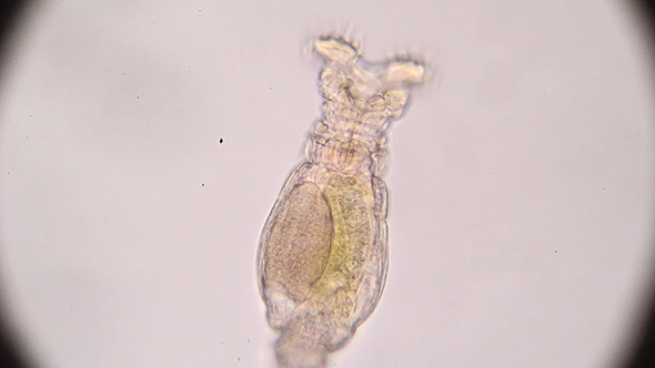Microscopy: Rotifer Mniobia Magna 14
