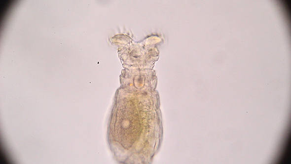 Microscopy: Rotifer Mniobia Magna 15