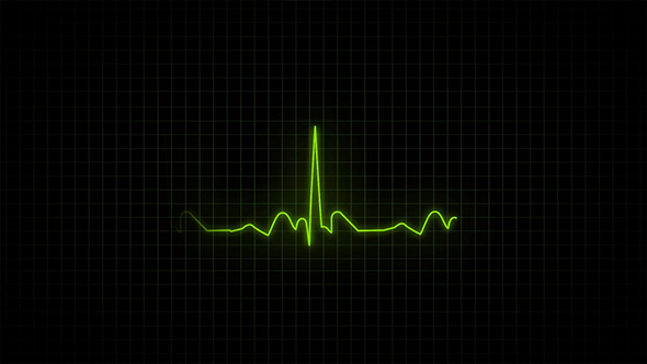 Heartbeat Monitor - Electrocardiogram