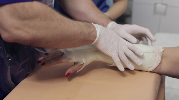 Doctor Lay On Gypsum On The Hand Female Patient alt
