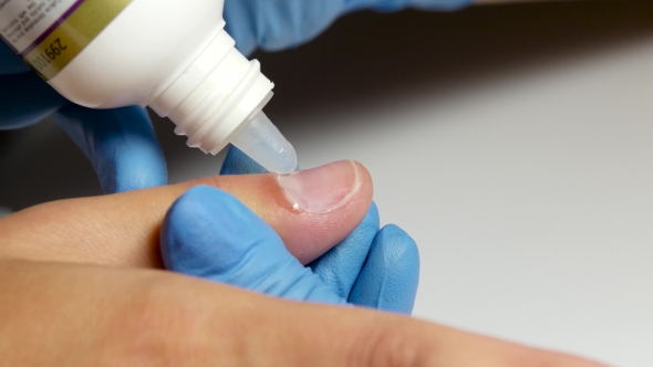 Manicure Deals Remover At The Cuticle. alt