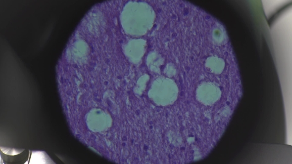 The Cell Tissue Under a Microscope alt