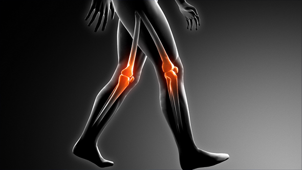 Walking Man Knee Medical Scan