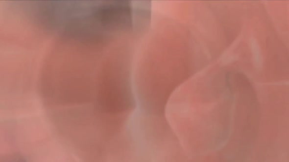 The growth that develops inside the colon is the name given to the colons.