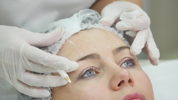 Doctor Draw Lines With Marker On Patient Face For Facial Plastic Surgery At Clinic