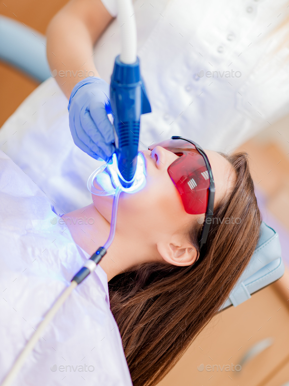 Laser Teeth Whitening - Stock Photo - Images