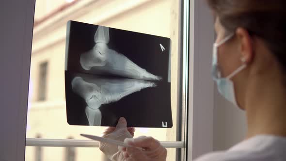 Doctor Examines Xray Film of Broken Foot