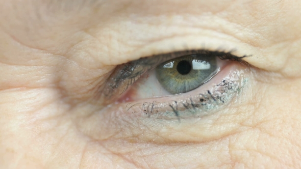 Woman Aged 60s Opens and Closes Up One Eye