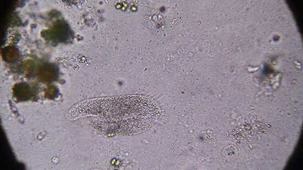 Microscopy: Stylonychia Ciliophora 01
