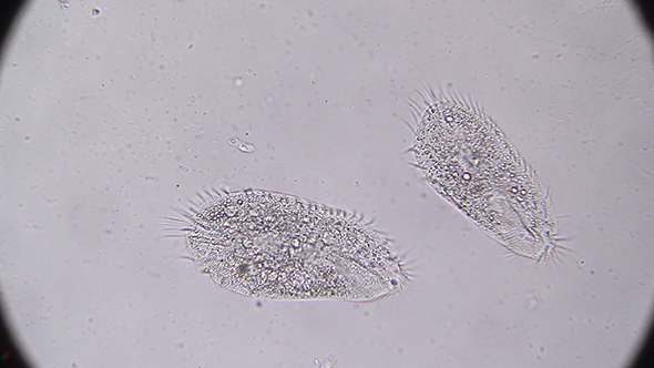 Microscopy: Stylonychia Ciliophora 02