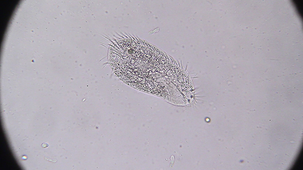 Microscopy: Stylonychia Ciliophora 03