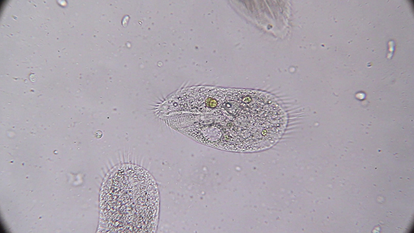 Microscopy: Stylonychia Ciliophora 04