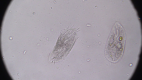 Microscopy: Stylonychia Ciliophora 05