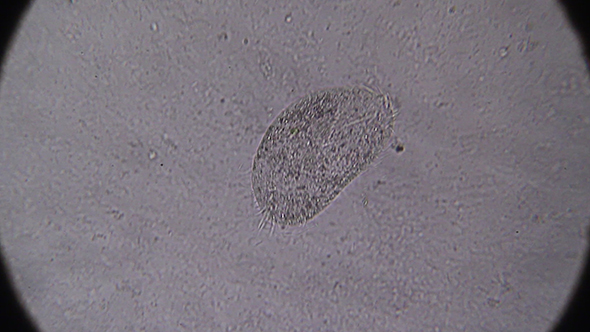 Microscopy: Stylonychia Ciliophora 06