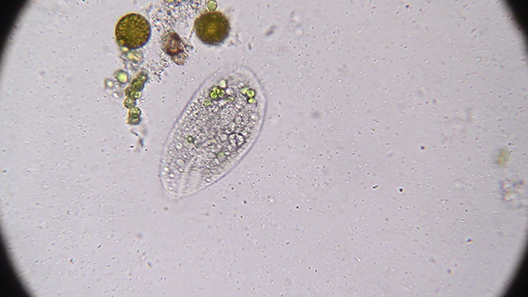 Microscopy: Stylonychia Ciliophora 07