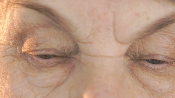 Old Woman Looks the Eyes in Different Directions