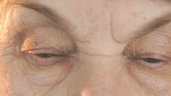 Old Woman Looks the Eyes in Different Directions alt