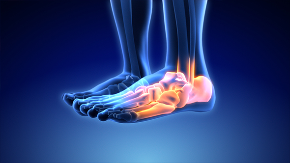 Male Having Acute Pain In The Ankle