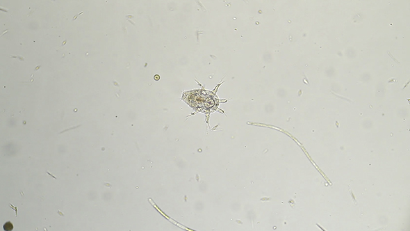 Microscopy: Copepod (Cyclops sp) Nauplius (shadowshador)