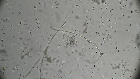 Microscopy: Loxophyllum Ciliado Ciliate 01