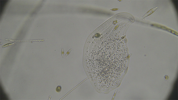 Microscopy: Loxophyllum Ciliado Ciliate 02